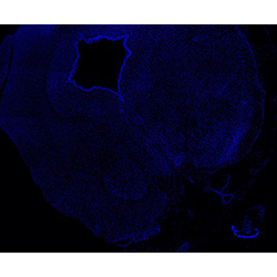 11PCW human midbrain
